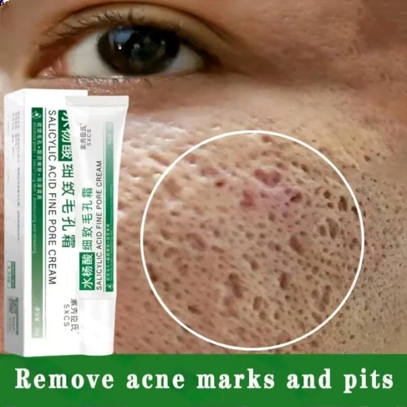 Korean Skincare Routine - Krem z kwasem salicylowym do oczyszczania