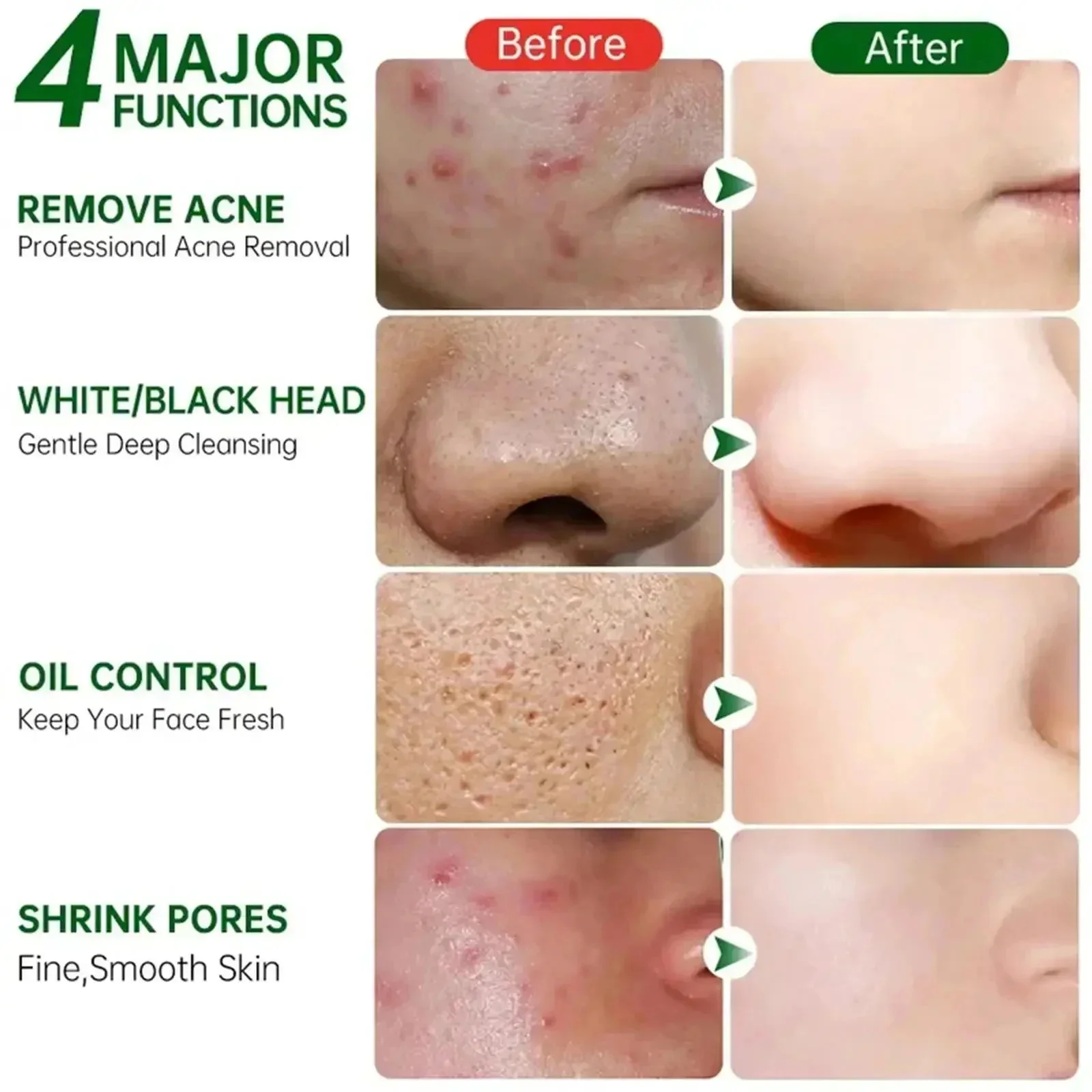 Krem z kwasem salicylowym do o – Korean Skincare Routine recenzja i cena