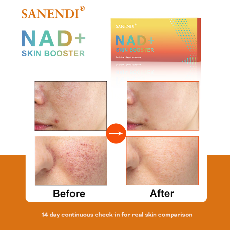 Sanendi NAD+ Korea Skincare Pr – Korean Skincare Routine recenzja i cena